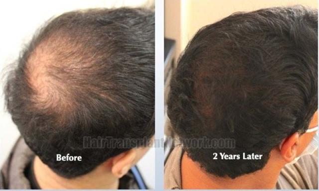 Right view of patient before and after