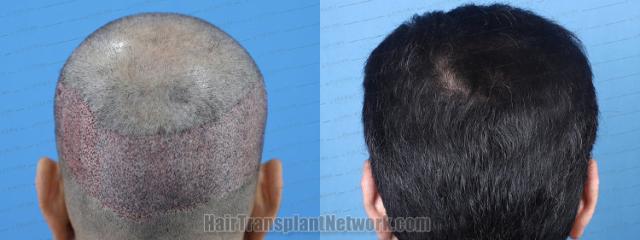  before and after result photographs