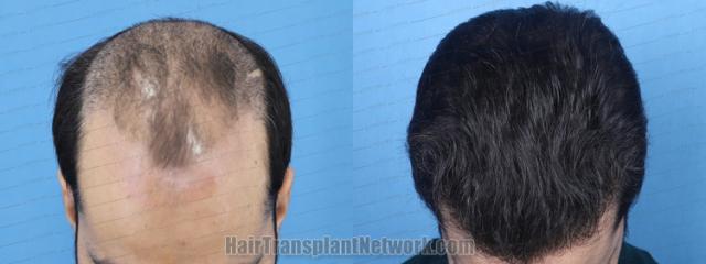  before and after result photographs