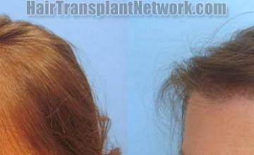 Female before and after photos