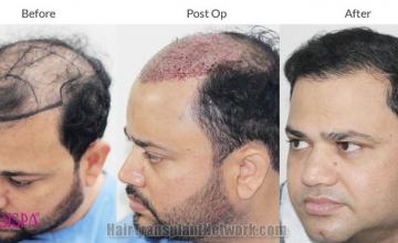 before and after photos