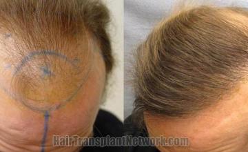 Before and after photos of  patient