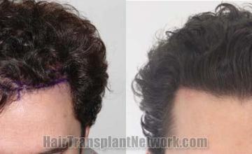 Front view - Before and after