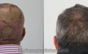  before and after result photographs