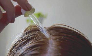 Alternative Hair Loss Treatment